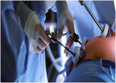 Bariatric Surgery : क्या आप भी मोटापे का है शिकार तो करवाए Bariatric Surgery ? जानिए इससे होने वाले फायदे व नुकसान… 1 image 4