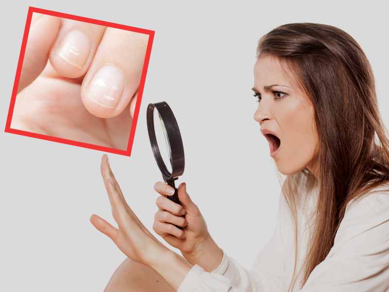 Nail Paint : क्या आप भी नेल पेंट के शौकीन है ? तो हो जाएं सावधान ! सेहत पर हो सकता है बुरा असर.. 1 nails spot big