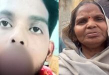 रील विवाद ने लिया खौफनाक मोड़, पत्नी ने पति की जीभ काटी