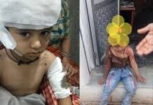 स्कूल के पहले दिन 4 साल के बच्चे पर कुत्तों का हमला, सुरक्षा पर बड़े सवाल