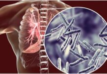 लक्ष्मी कमर्शियल और SRS ट्रेडर्स पर जीएसटी का छापा