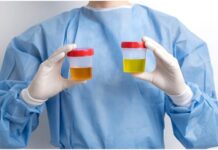 बार-बार प्यास और पेशाब आना, डायबिटीज का संकेत