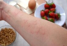 रोज कच्चा प्याज खाते हैं? इन लोगों को तुरंत बंद कर देना चाहिए