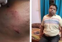 कोटा थर्मल प्लांट में भालू का आतंक: ड्यूटी पर जा रहे ऑपरेटर के चेहरे पर मारा पंजा