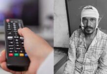 ति को रिमोट से चैनल बदलना पड़ा भारी, पत्नी ने हंसिए से किया ताबड़तोड़ वार, सिर और गाल पर आई चोट