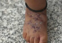 ट्रेन में अचानक टूटा गिलास, गर्म पानी गिरने से मासूम बच्चा हुआ घायल